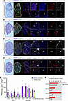 Kif11 coexpression with Flt4-positive lymphatic vessels during mouse embryo