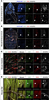 EG5 protein coexpression with VEGFR3-positive lymphatic vessels during mous