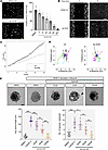 KIF11 deficiency impairs LEC migration and sprouting.