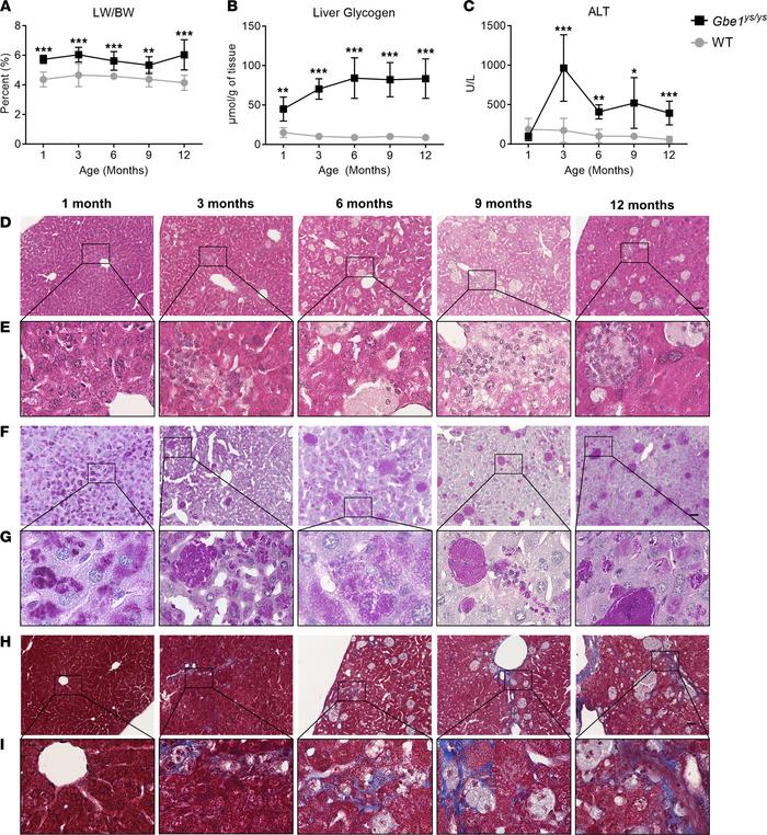 
Gbe1ys/ys mice exhibit liver involvement.
(A) Liver weight (LW) was nor...