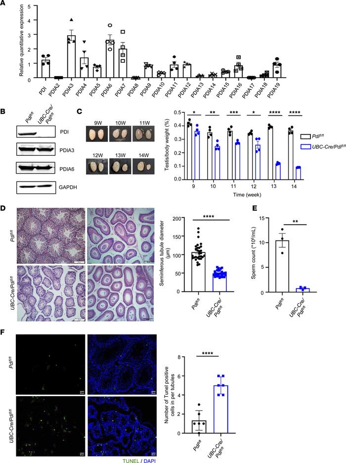 PDI is expressed in testes and its deficiency selectively causes signifi...