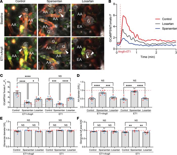 Effects of sparsentan and losartan on glomerular hemodynamic changes cau...