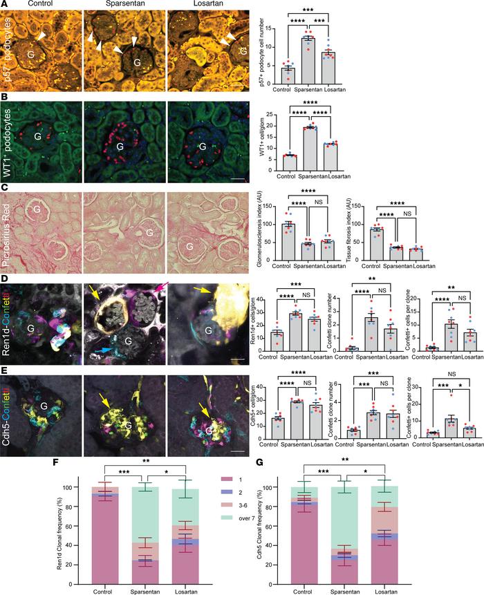 Effects of sparsentan and losartan on podocyte number, glomerulosclerosi...