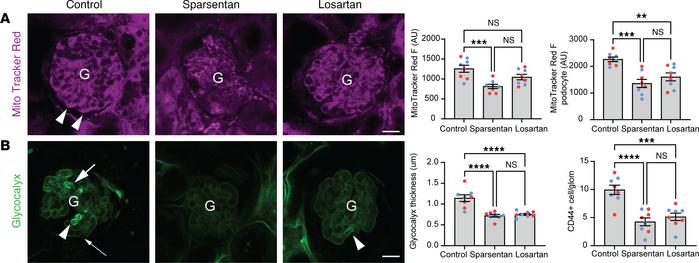 Effects of sparsentan and losartan on glomerular cell metabolism, endoth...
