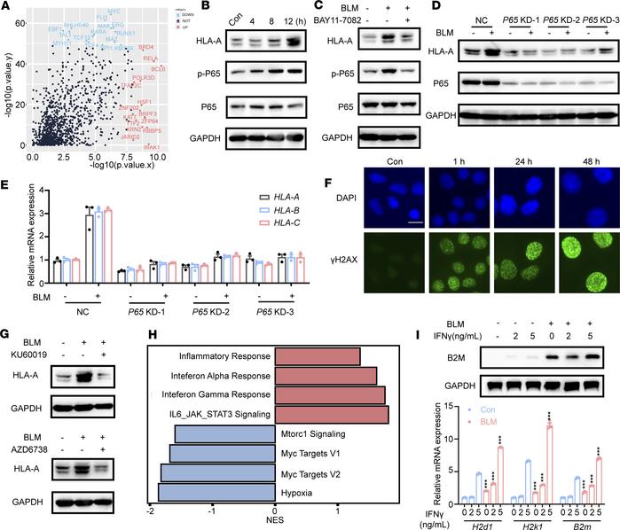 MHC-I upregulation caused by BLM depends on ATM/ATR–NF-κB activation.
(A...
