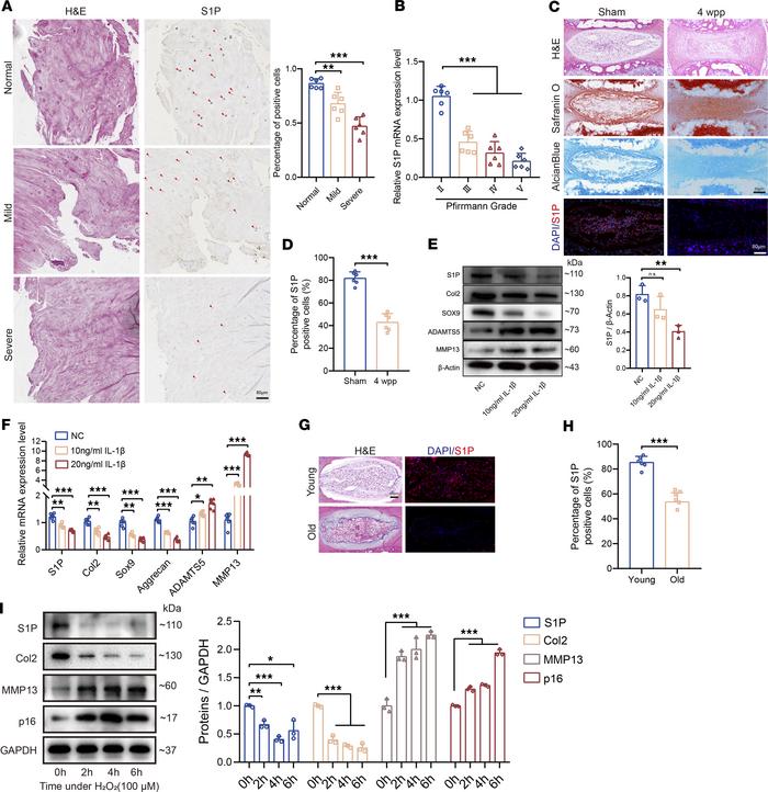 The expression of S1P in degenerated and aging IVD.
(A) IHC was used to ...