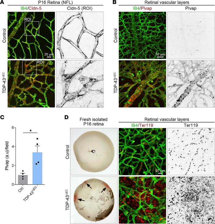Endothelial TDP-43 is critical for BRB.
(A) Confocal high-magnification ...