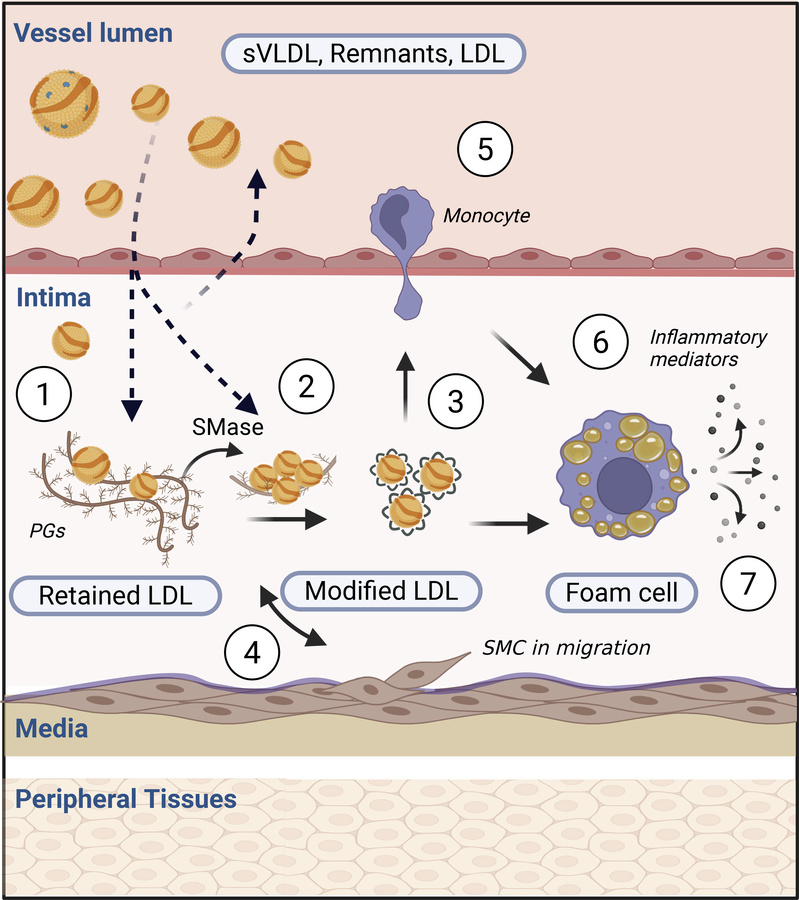 Illustration of the response to retention model of atherogenesis.
Initia...