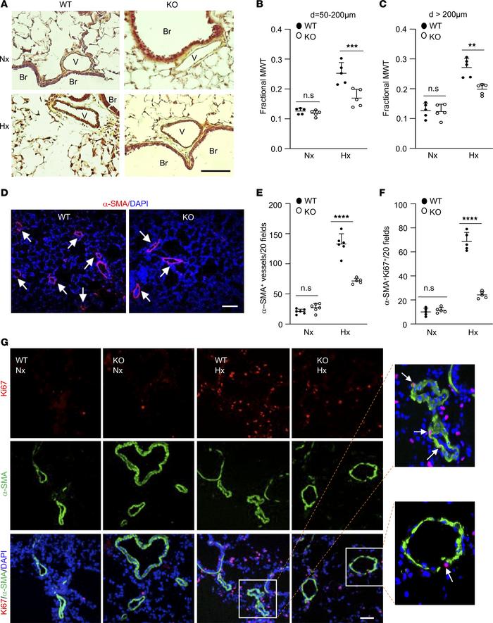 Reduced pulmonary vascular remodeling in hypoxic KO mice compared with h...