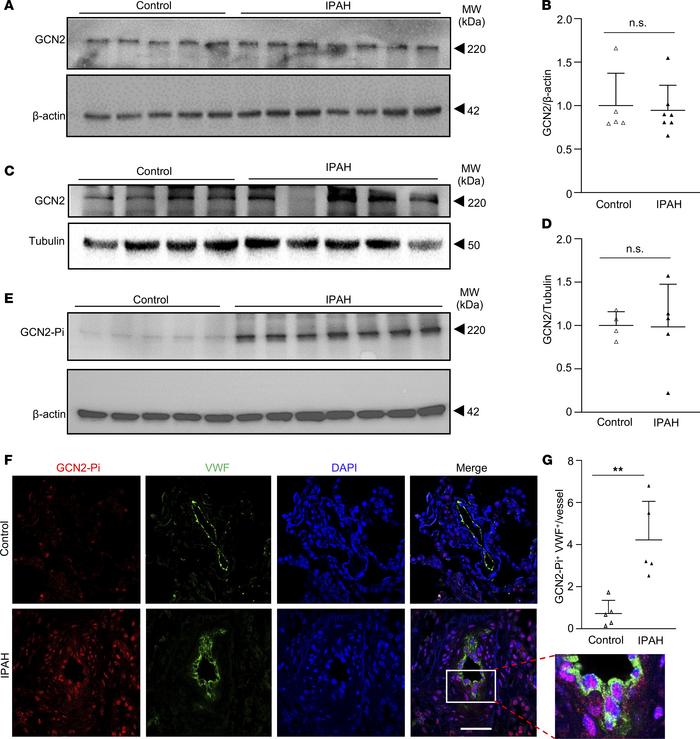 Prominent GCN2 phosphorylation/activation in ECs of pulmonary vascular l...