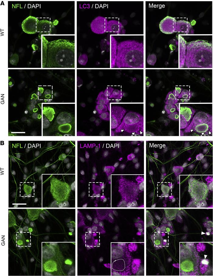 Neurofilament aggregates alter autophagosome spatial distribution.
(A) R...