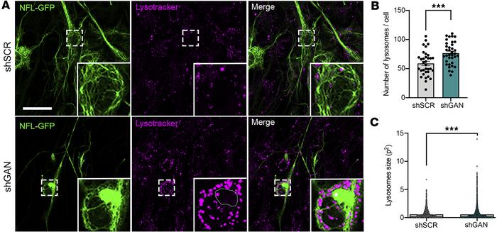 Lysosomal changes in GAN.
(A) Representative live-imaging fluorescence i...