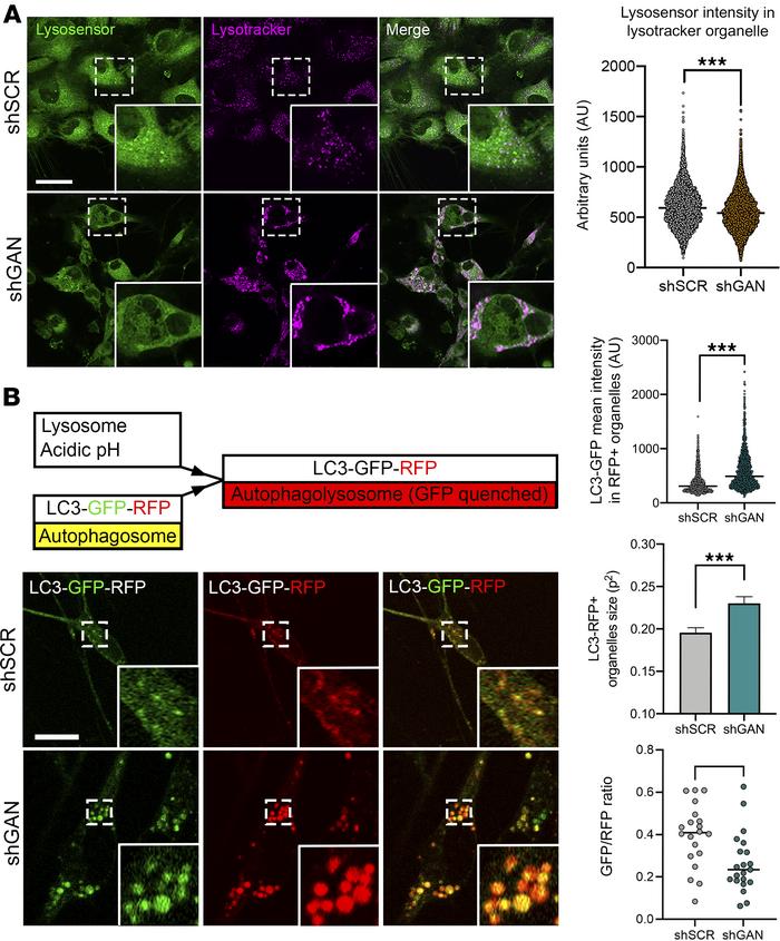 Lysosomal acidity and function are dysregulated in GAN.
(A) Representati...