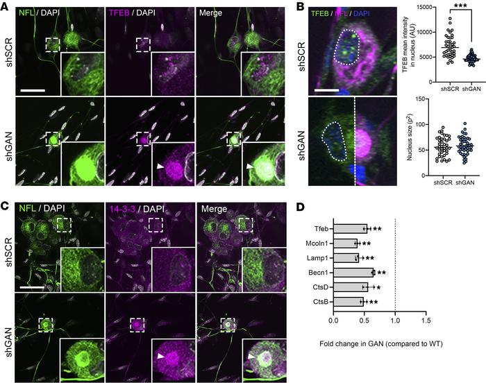 Neurofilament aggregates recruit TFEB and impair its nuclear translocati...
