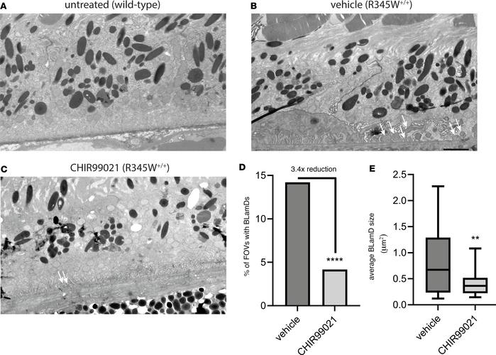 CHIR99021 significantly reduces the formation of basal laminar deposits ...