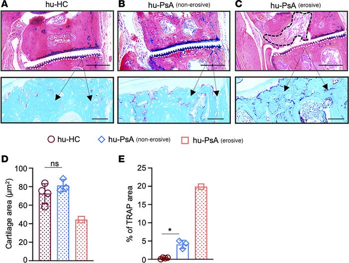 Bone damage in hu-PsA mice.
(A) hu-HC and (B) hu-PsA mice stained with A...