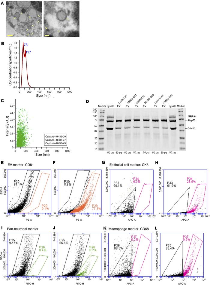 Colonic EV characteristics and origin.
(A) Representative electron micro...