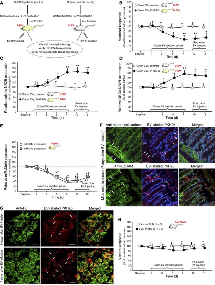 In vivo induction of visceral hypersensitivity following i.p. injection ...