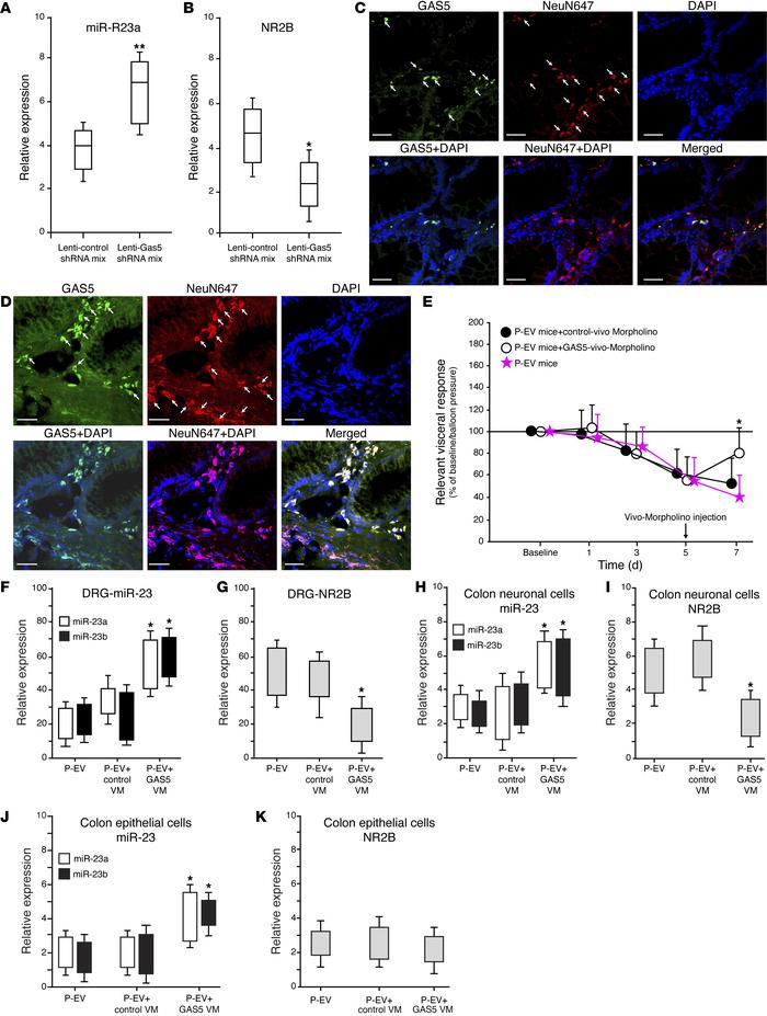 Silencing or knockdown of GAS5 regulated miR-23 and NR2B expression.
(A)...