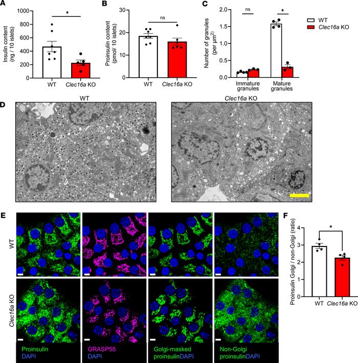 Mitochondrial dysfunction leads to decreased insulin content.
Clec16afl/...