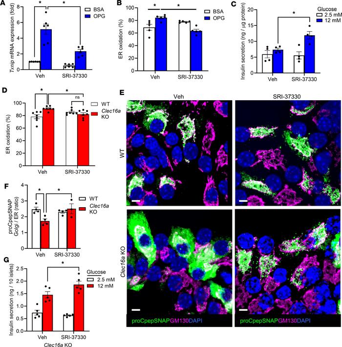 
Txnip suppression restores ER redox homeostasis, proinsulin trafficking...