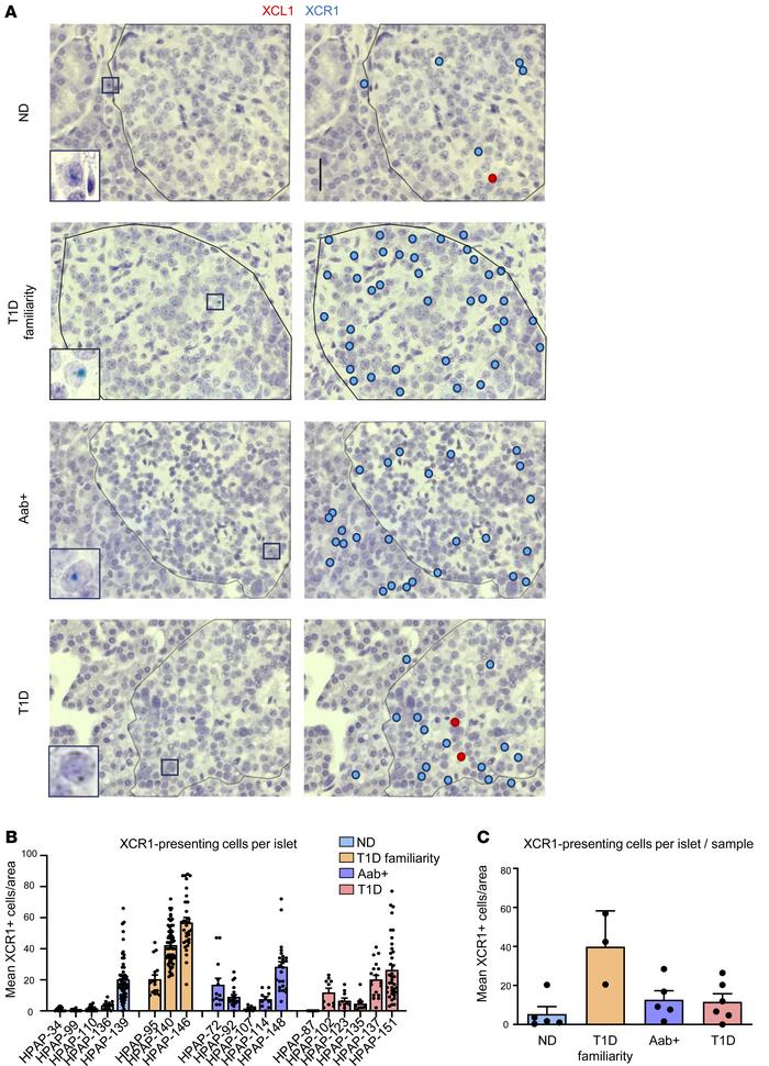 XCR1+ cDC1 are present in the islets of patients with T1D and individual...
