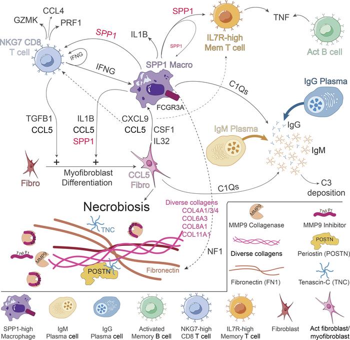 Graphical representation of necrobiosis pathophysiology.
SPP1hi macropha...