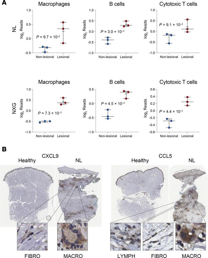 Deconvolution analysis identifies increased macrophages, B cells, and cy...