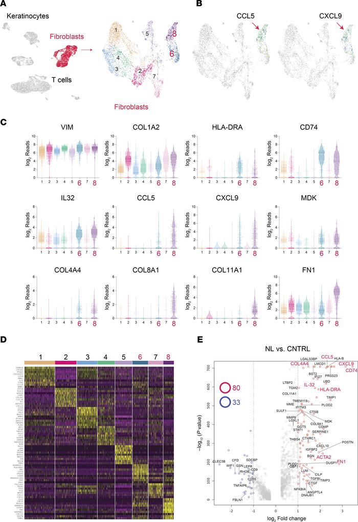 Single-cell analysis identifies a population of CCL5hi fibroblasts in NL...
