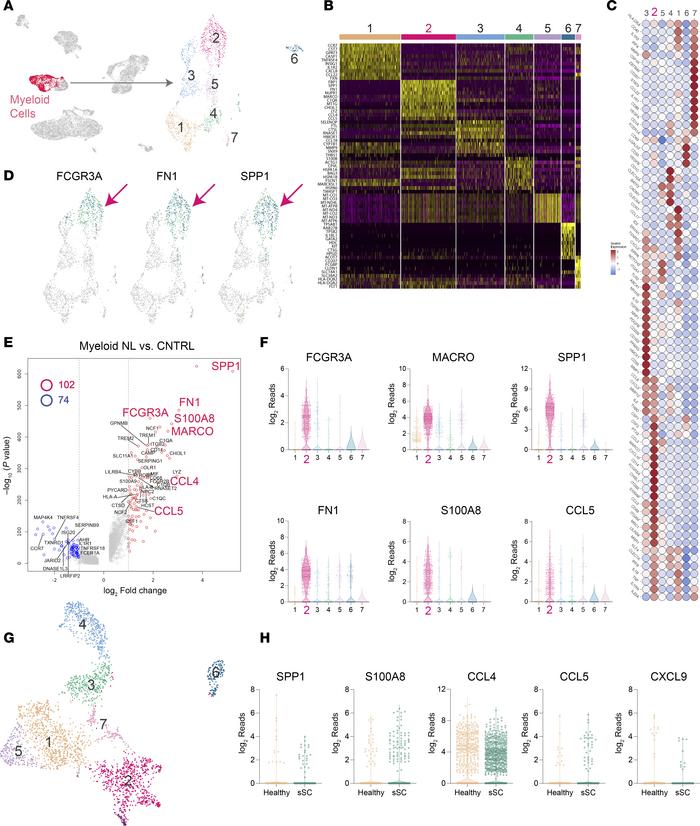 Single-cell analysis identifies a population of SPP1hi macrophages in NL...
