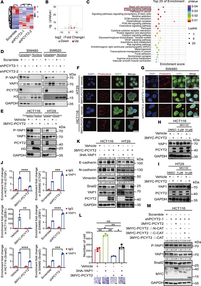 PCYT2 affects the phosphorylation levels of YAP1 and changes the proport...