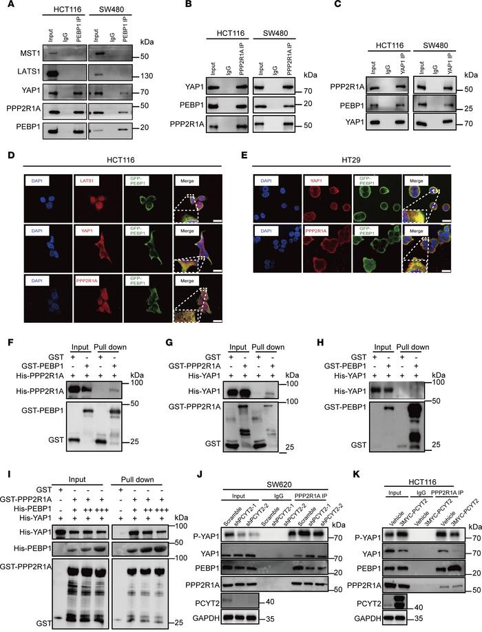 PPP2R1A interacts with YAP1 and PEBP1.
(A) Detection of the interaction ...