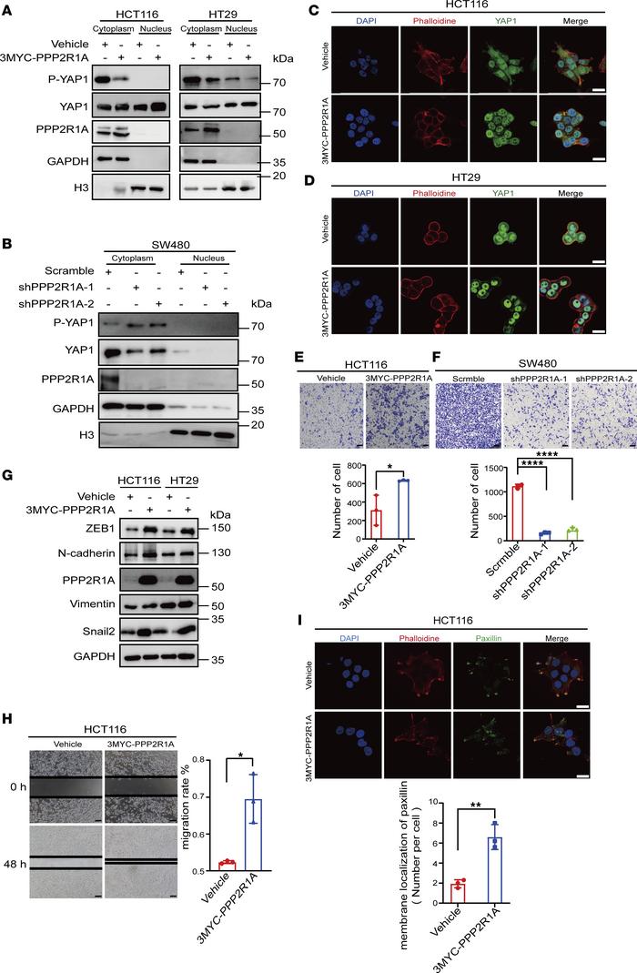 PPP2R1A dephosphorylates YAP1 and leads to changes in the proportion of ...