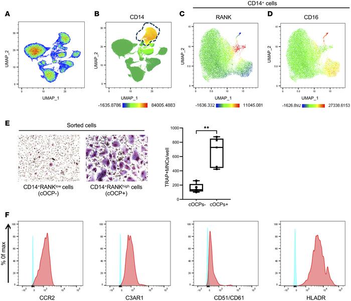Analysis of circulating osteoclast precursor cells.
(A–D) UMAP analysis ...