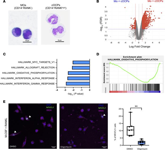 Circulating osteoclast-precursor cells have distinct morphology and tran...