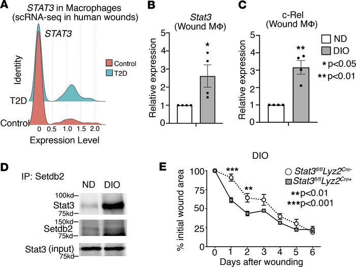 STAT3 is increased in diabetic wound macrophages during the transition t...