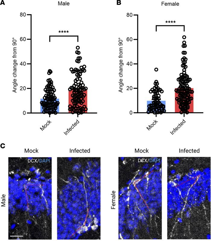 Newborn neuron growth is altered in infected mice.
(A and B) DCX angle i...