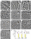 AO-based evaluation of cone photoreceptor density.