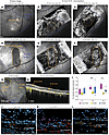 OCT-A–based evaluation of choriocapillaris perfusion.