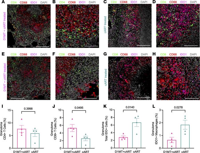 Dynamics of T cells and macrophages in the lung granulomas after D1MT+cA...