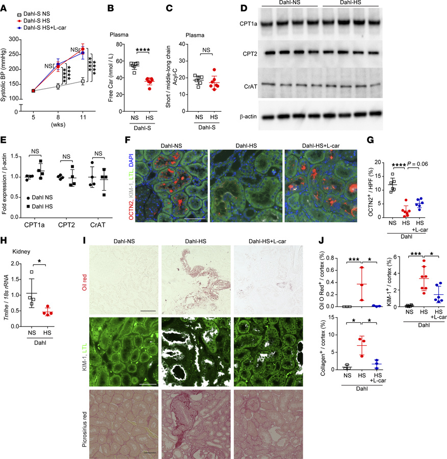 Salt-sensitive hypertension partially induces PTC carnitine deficiency w...