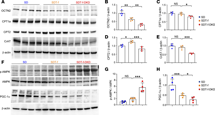 FAO-related transporter and enzymes are reduced in SDT-f-DKD rats.
(A) W...