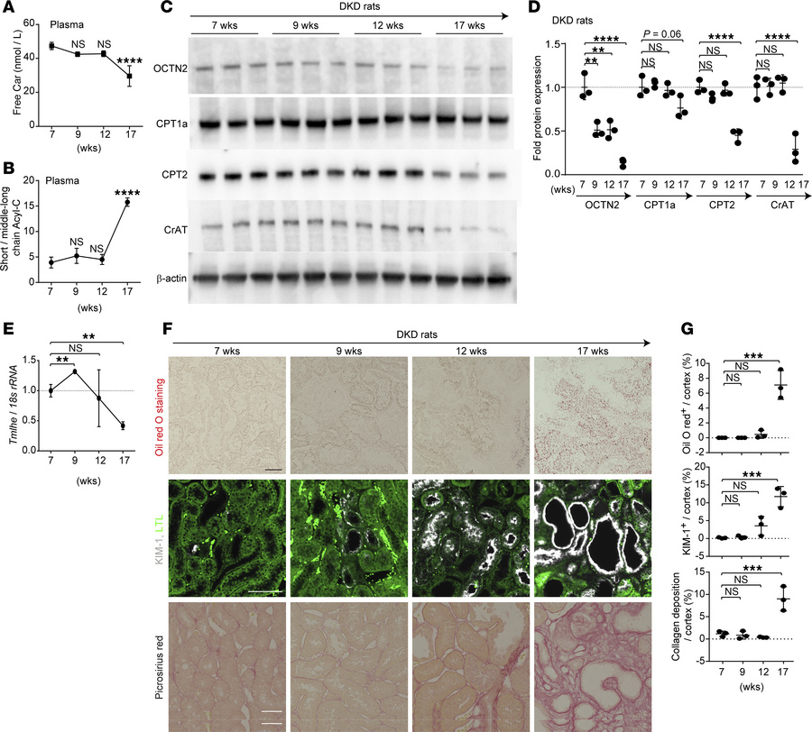 Reduced FAO enzymes and morphological changes in mitochondria following ...