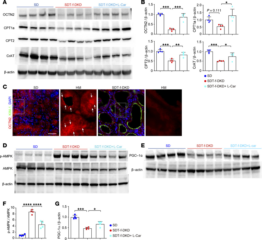 Carnitine-related transporters and enzymes are preserved by l-carnitine ...