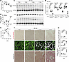 Reduced FAO enzymes and morphological changes in mitochondria following the