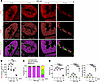 Mitochondrial fragmentation is observed in the late stage of disease progre