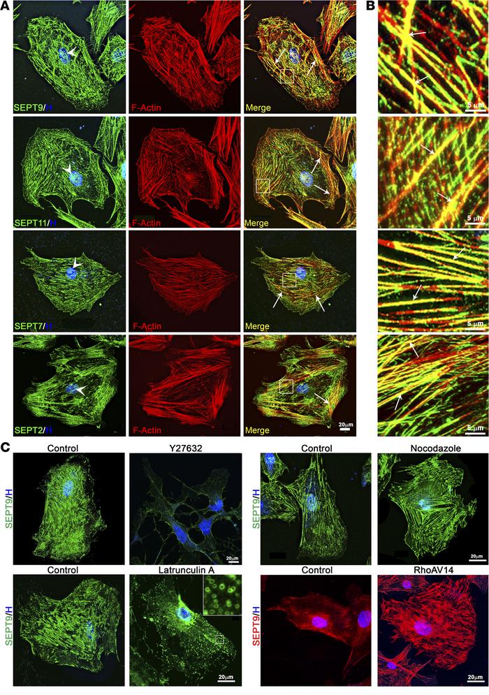 Septin colocalization with actin stress fibers and the impact of cytoske...