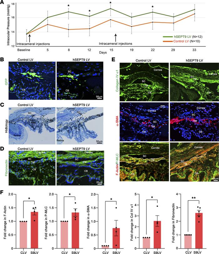 Elevation of IOP in mice expressing increased levels of human SEPT9 in t...