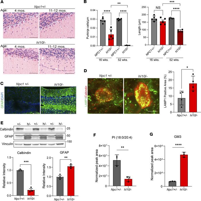 Age-dependent neurodegeneration in humanized I1061T NPC1 mice.
(A) Midli...
