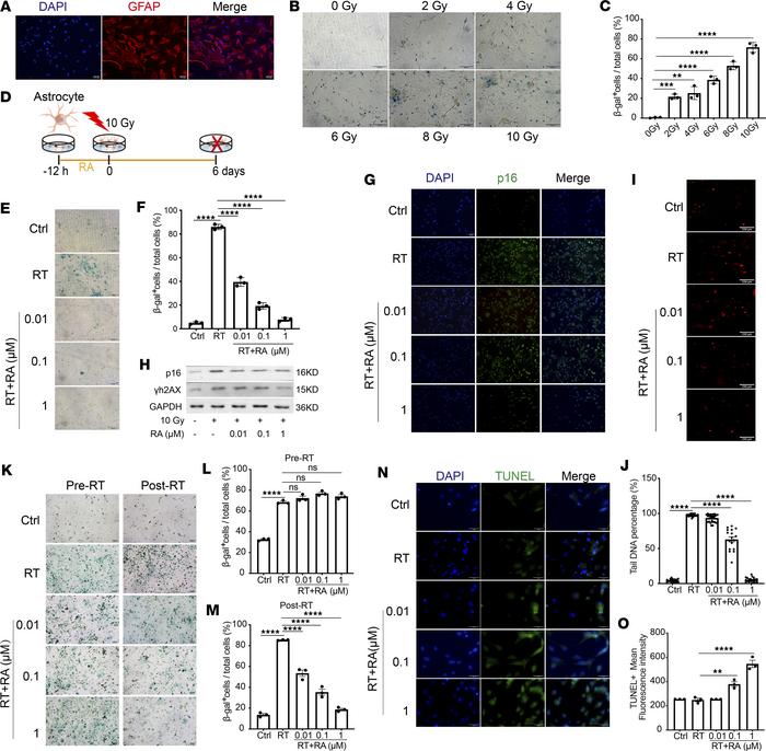 RA eliminates senescent mouse astrocytes after radiation in vitro.
(A) P...